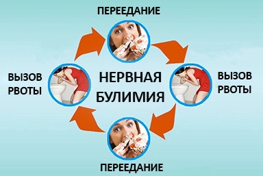 Лечение булимии в Майском